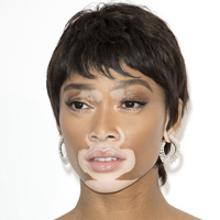 Best Skin Specialist in lucknow